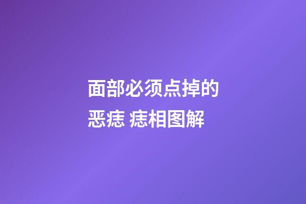 面部必须点掉的恶痣 痣相图解